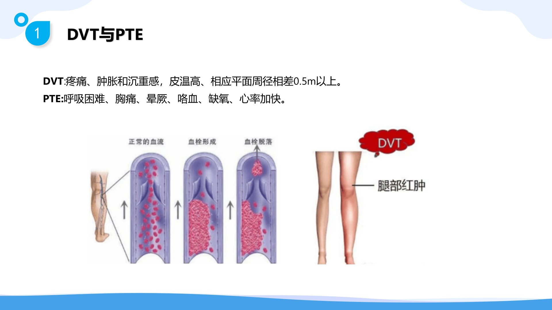 图片[6]-静脉血栓栓塞症(VTE)的-预防与护理 PPTx(共72 页)-医护资料网